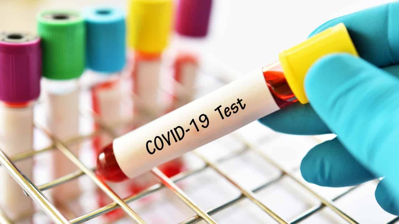 exames para coronavírus