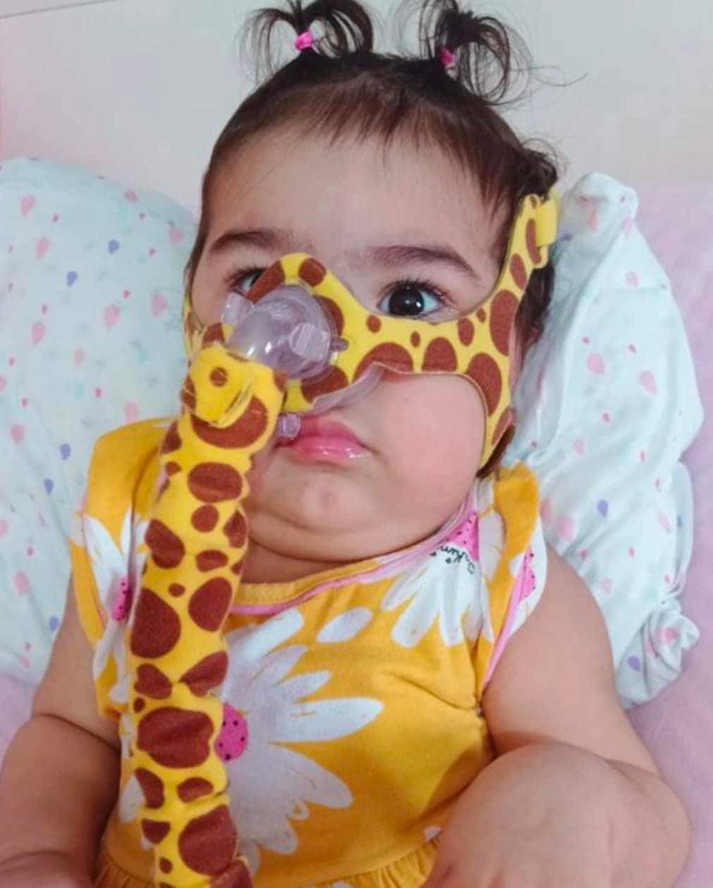 Bebê branca com cabelos escuros e com um respirador no nariz