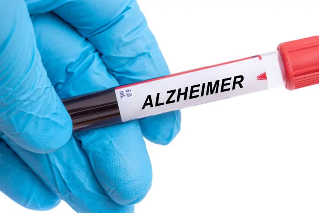 Alzheimer