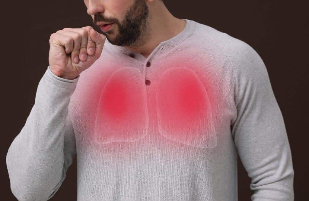 Pneumonia