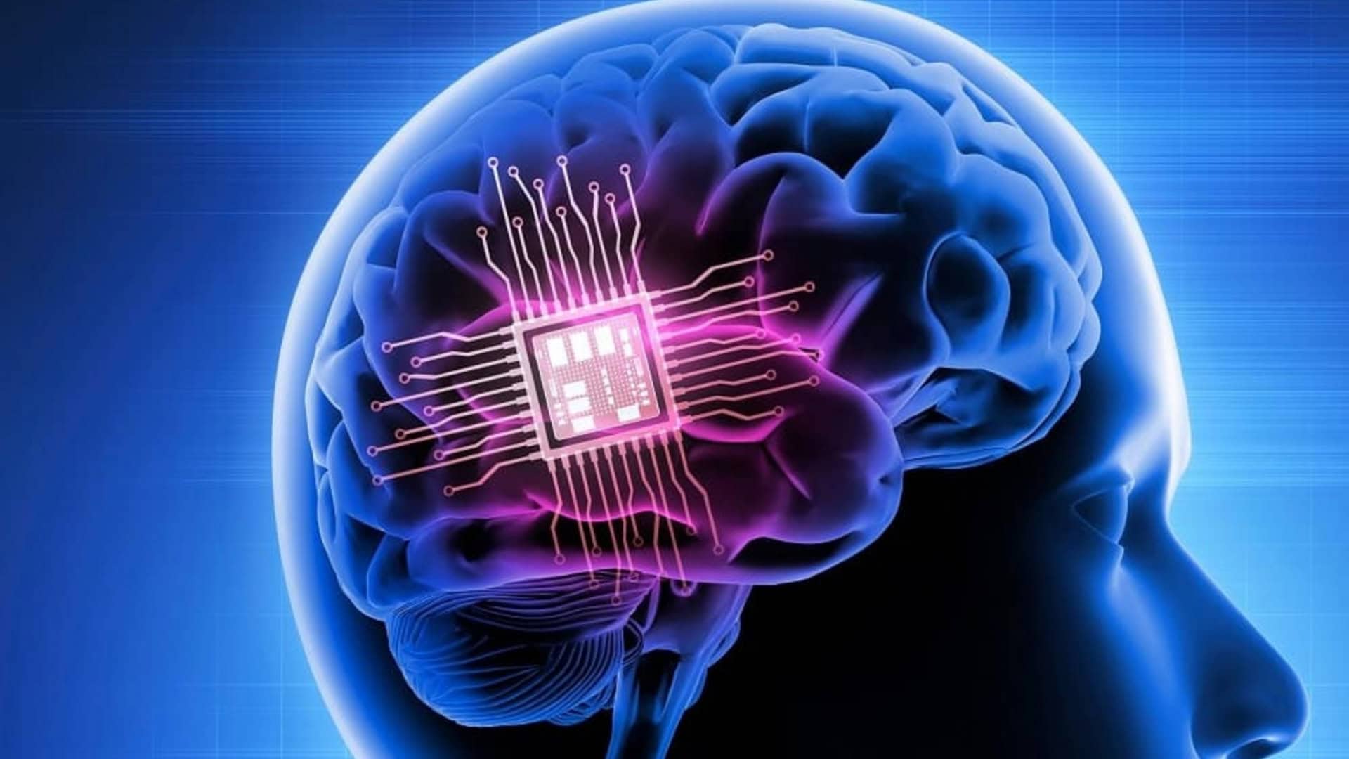 Reino Unido autoriza chip cerebral de Musk em pacientes humanos