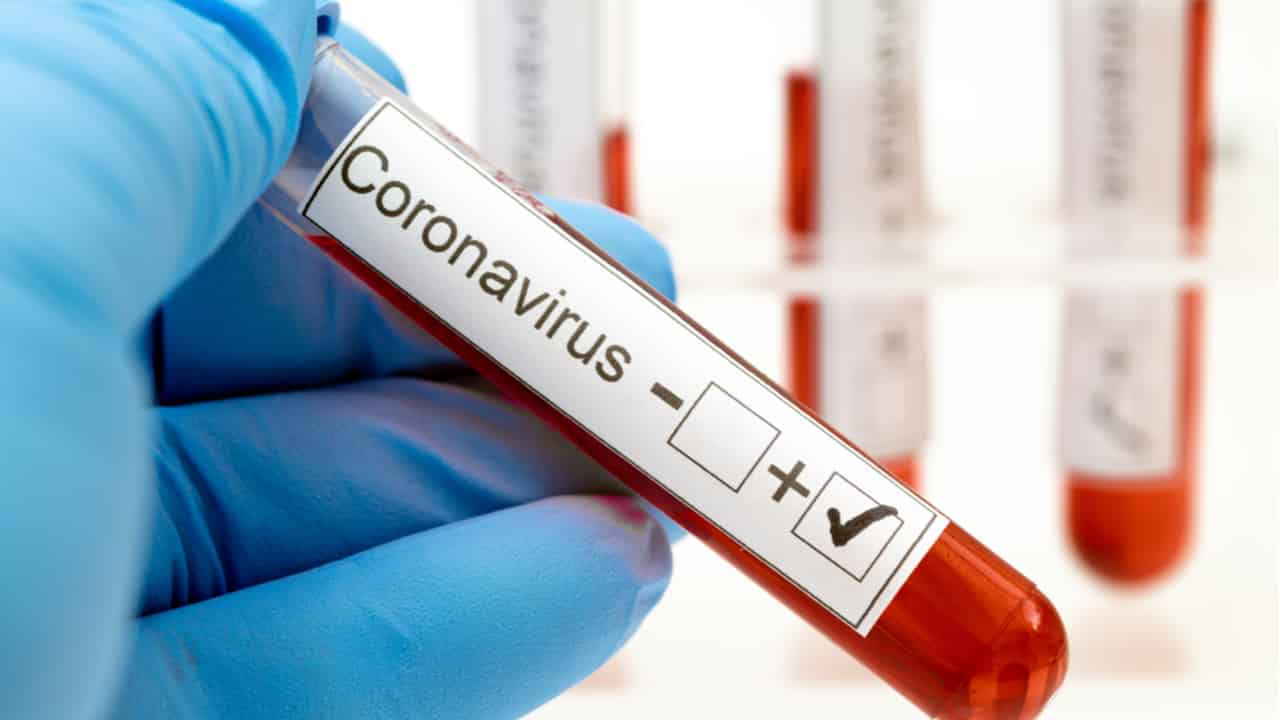 Coronavírus: Bradesco, Itaú e Santander vão comprar 5 milhões de testes