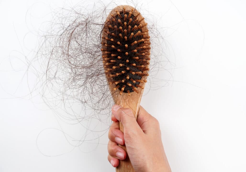 O que ninguém te contou sobre Ozempic, Mounjaro e perda de cabelo