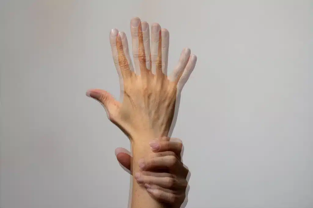 Parkinson
