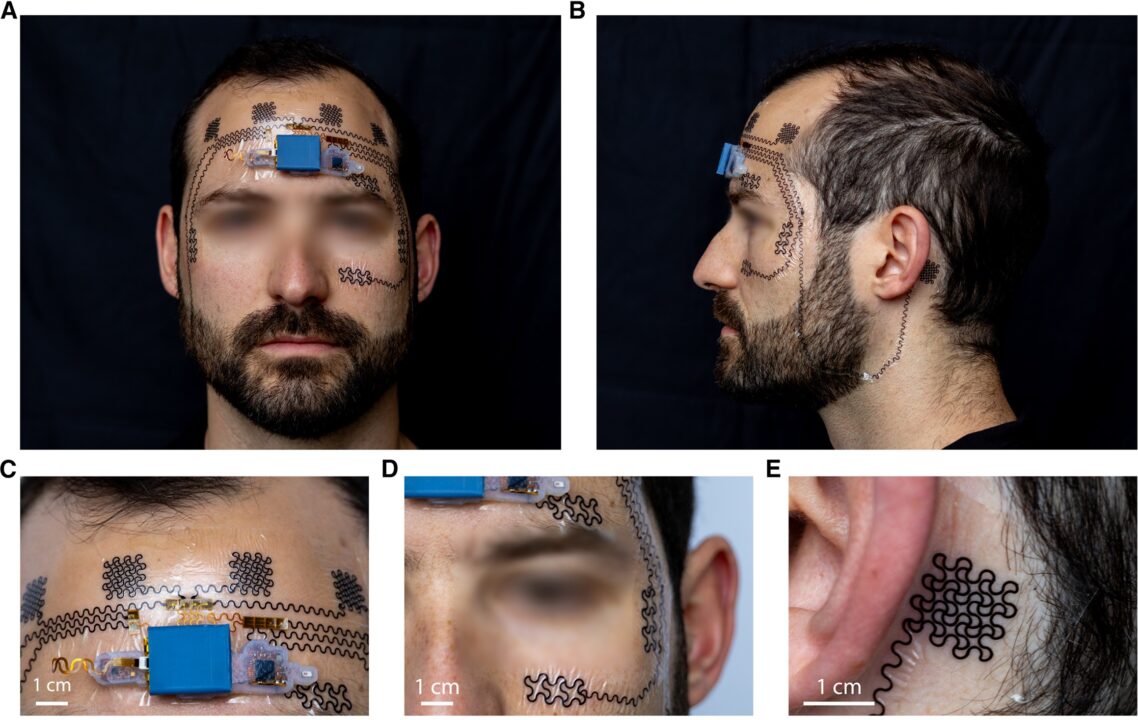 Tatuagem eletrônica pode prever burnout antes dos primeiros sintomas