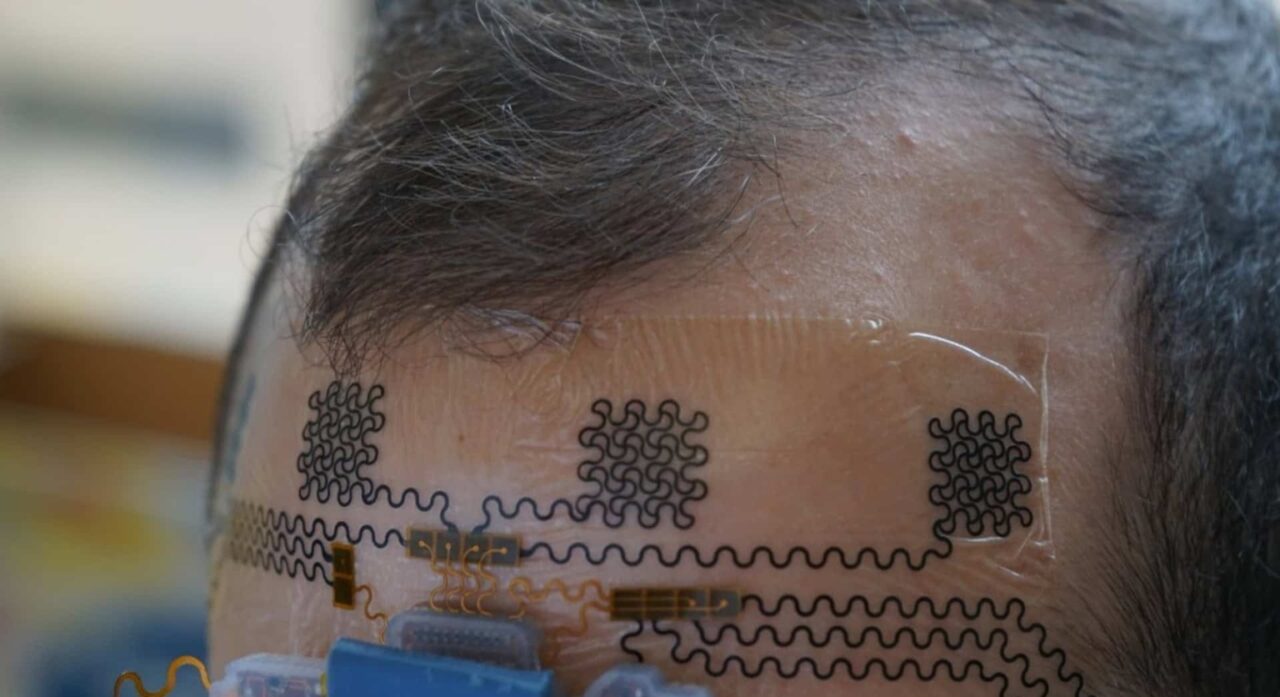 Tatuagem eletrônica pode prever burnout antes primeiros sintomas