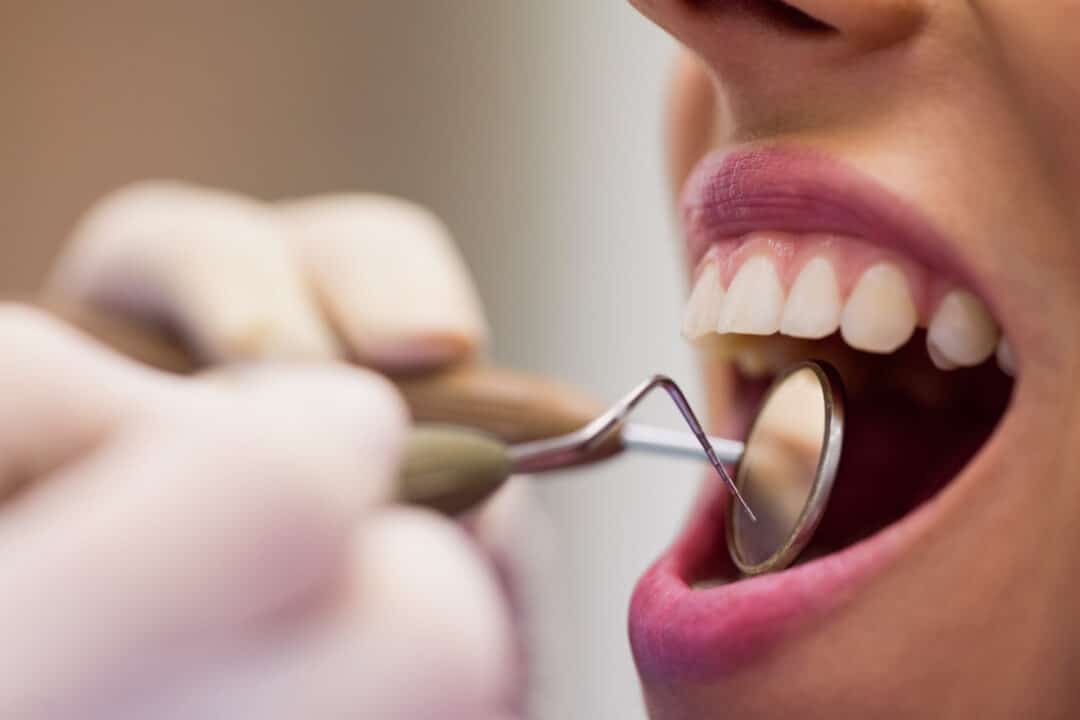 dentes