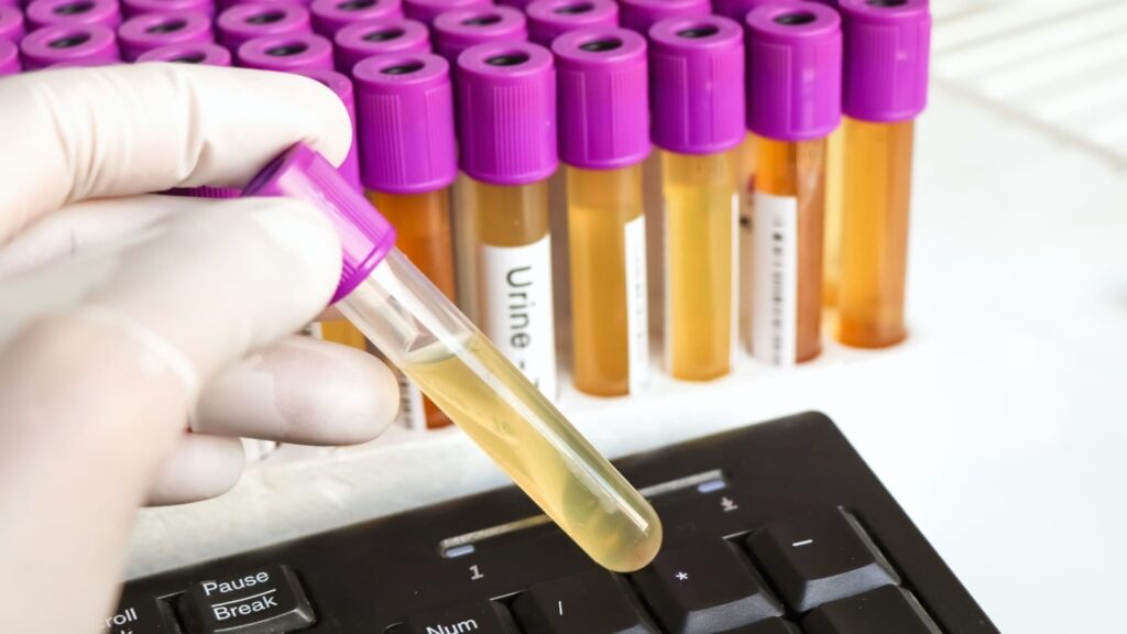 Exame toxicológico